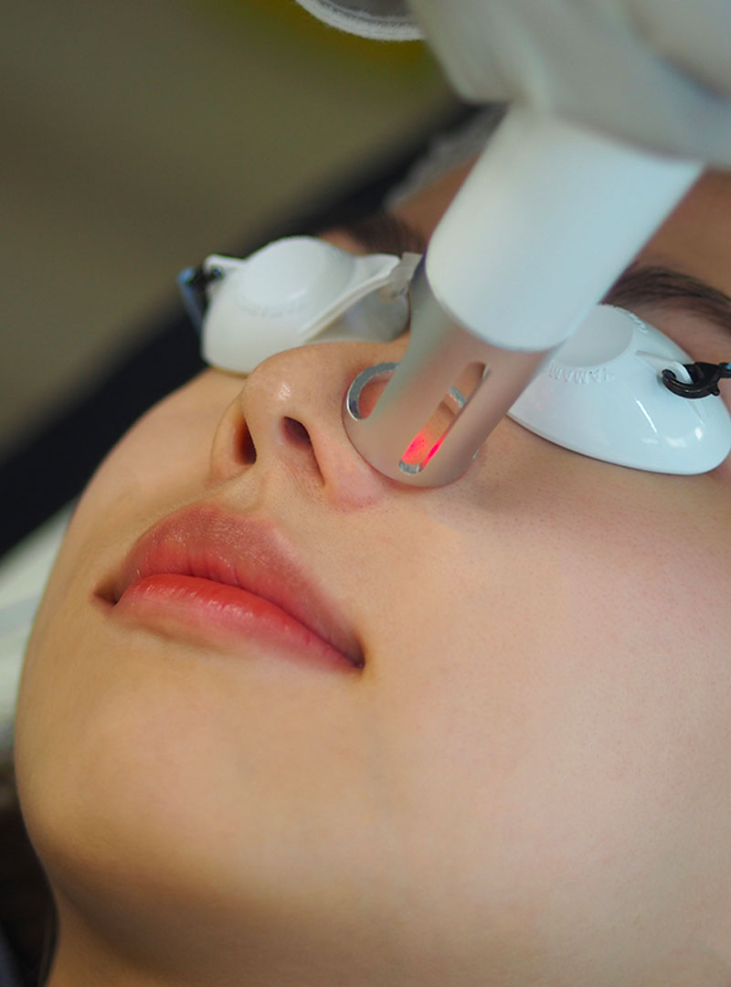Aesthetic Clinic in Abu Dhabi 2 Fractional laser treatment Abu Dhabi for skin resurfacing and rejuvenation