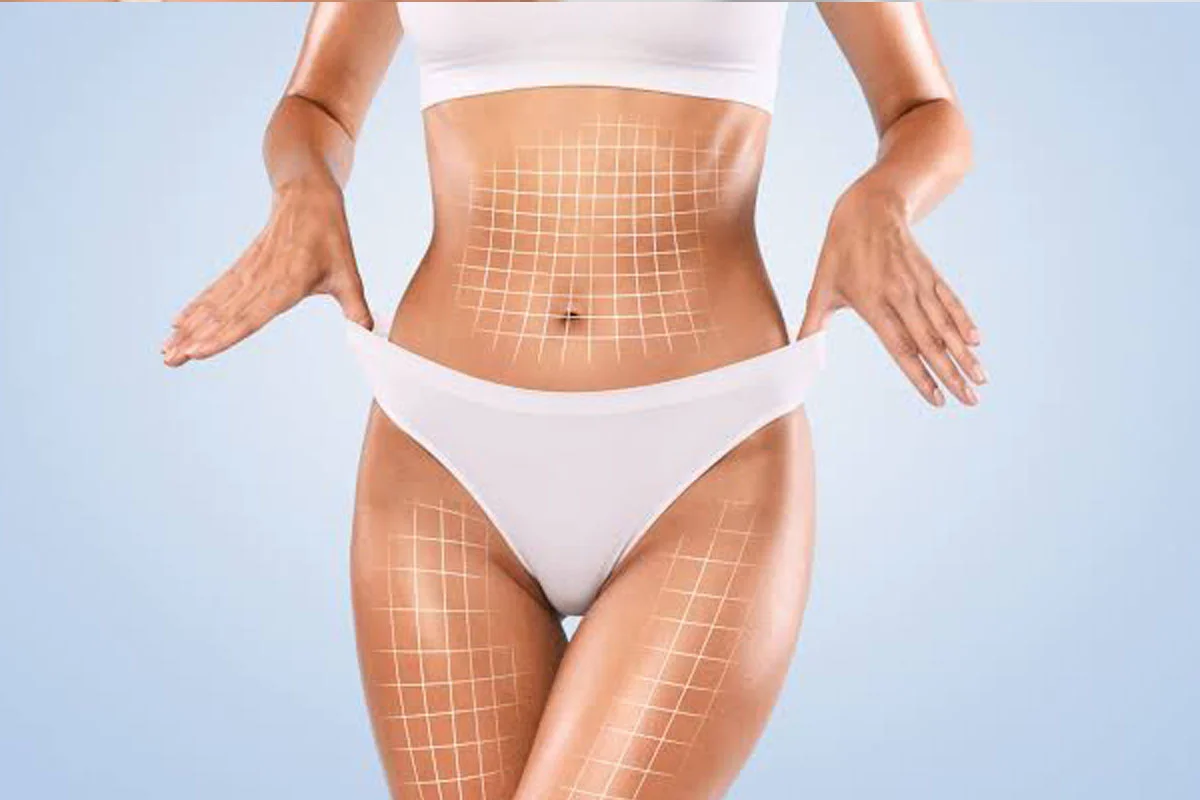 Body Contouring