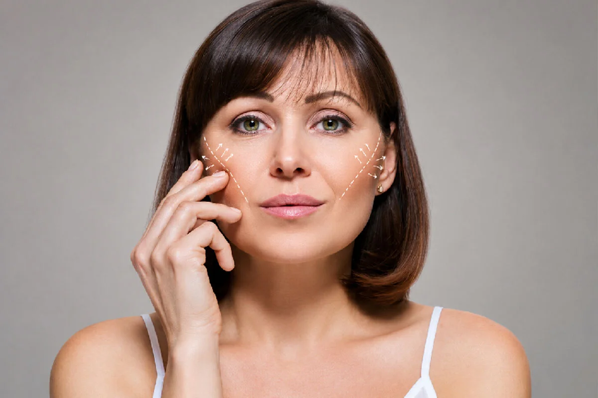 Cheek Implants