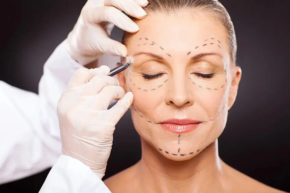 Facial Surgery 1